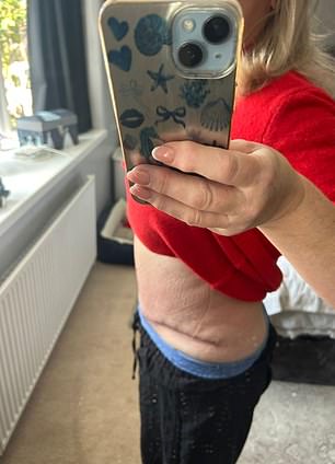 And after the op earlier this year