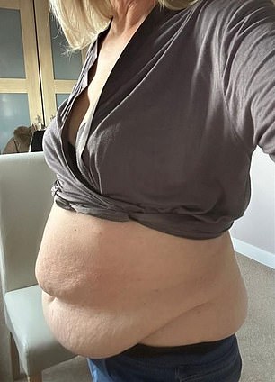 June's tummy before the operation