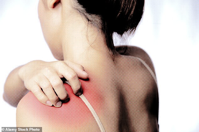 The number of Britons living with psoriasis has risen nearly ten per cent in the past decade. Pictured: File photo