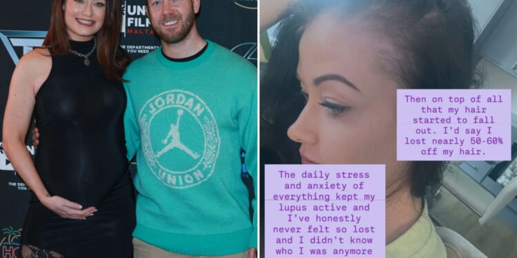 Pregnant Jess Impiazzi reveals devastating battle with lupus as hair falls out and rashes appear on her body