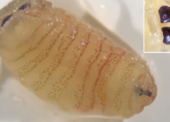 Woman sneezes 1-inch WORMS out her nose
