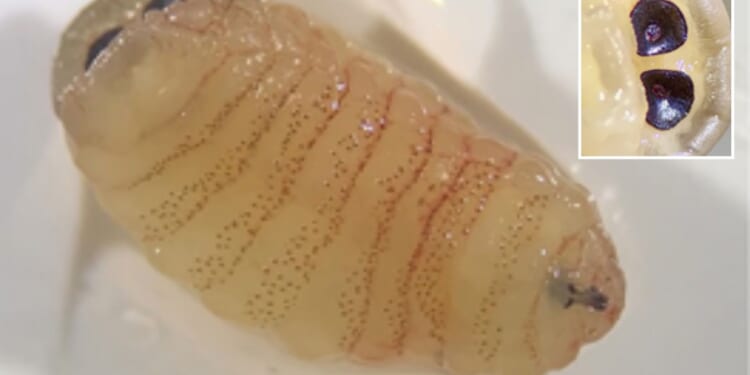 Woman sneezes 1-inch WORMS out her nose