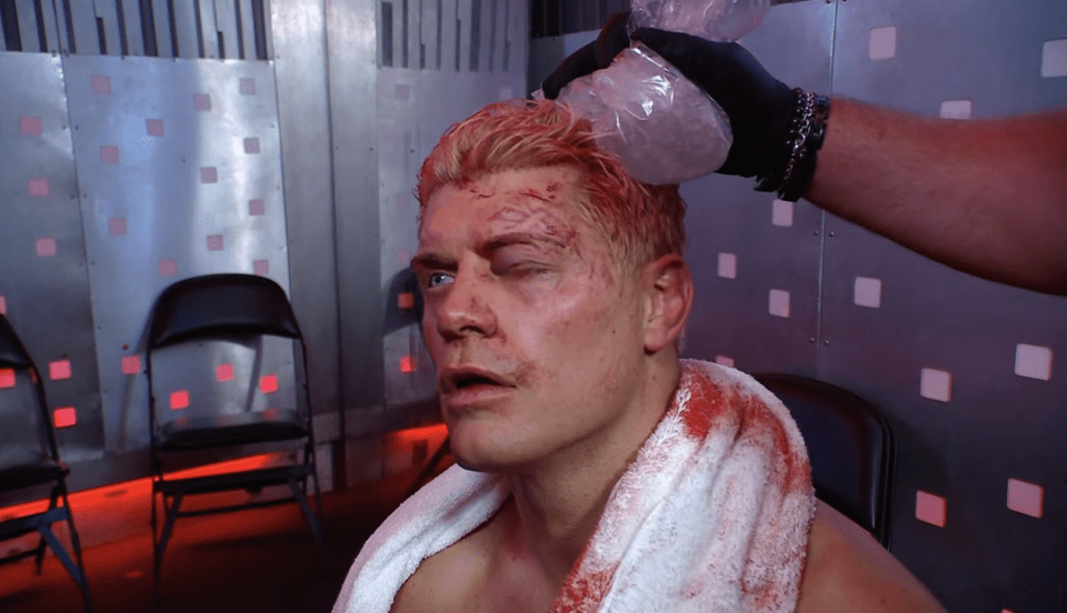 A person with a bloodied face and blond hair has an ice pack held to their head.