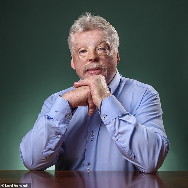 British Army veteran Simon Weston (pictured), 64, who suffered severe burns during the war, said: 'What it [the Falklands] has to do with Mr Trump, I have no idea'