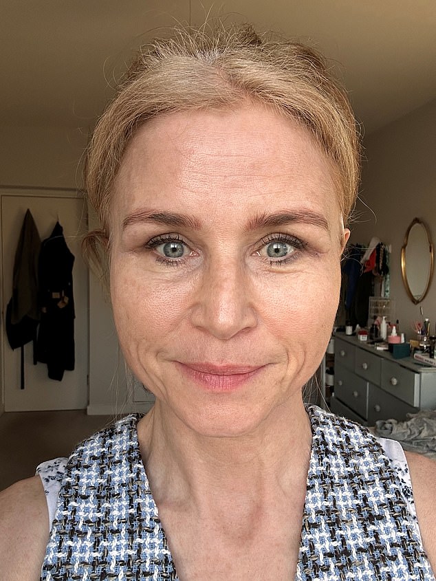 Ten days after the procedure the improvements were visible