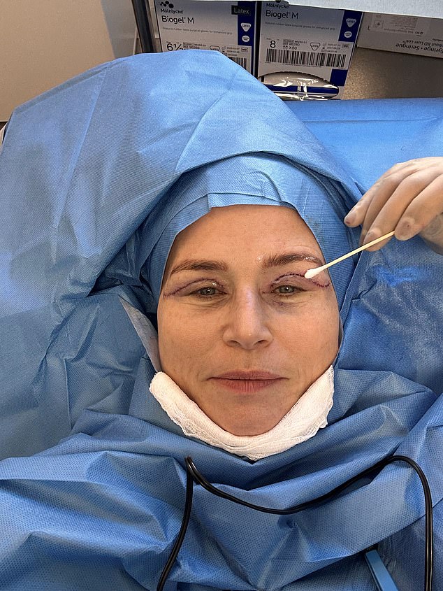 The treatment can be done in a lunch break, adding to its appeal