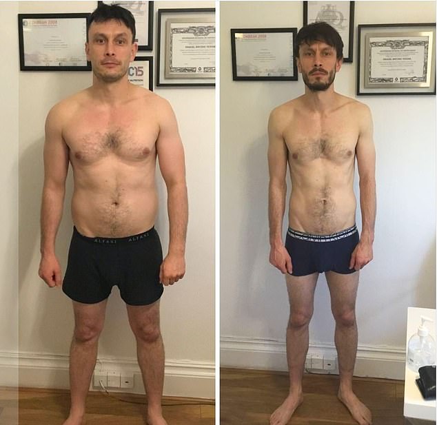 In Baby Reindeer, Gadd dropped from 15st to 10kg to better recall the gaunt version of his younger self on which the story was based