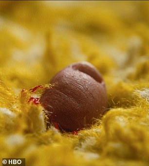 They severed his right pinky toe with a pair of clippers