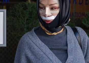 Big Brother legend Nadia Almada appeared totally unrecognisable as she emerged from a Turkish hospital after undergoing a facelift