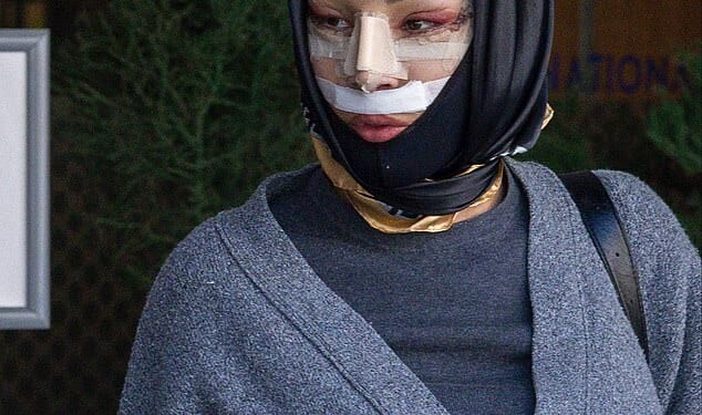 Big Brother legend Nadia Almada appeared totally unrecognisable as she emerged from a Turkish hospital after undergoing a facelift