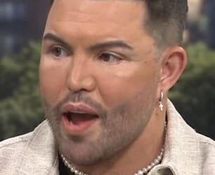 'What has he done?' Bobby Norris left This Morning viewers in shock on Wednesday as he unveiled his new look on This Morning, (left) and revealed how a decade of 'abusing fillers' and online trolls led him to have a facelift aged just 39