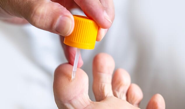 The most common treatment for warts is a topical ointment called salicylic acid