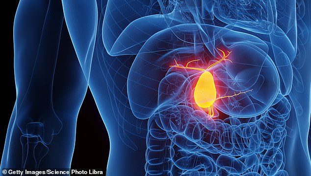 A trip to the ship's medical centre showed that she had an inflamed gallbladder – which can affect up to one in 100 people taking weightloss jabs such as Mounjaro