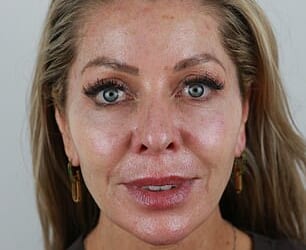 As the Real Housewives of London castmate Juliet Mayhew (pictured before her facelift) approaches 50, ageing, inevitable for anyone, has become harder to ignore, she told the Daily Mail