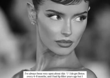 Maura Higgins has revealed the tweakments she has undergone after leaving fans stunned by her equally ageless and unrecognisable appearance