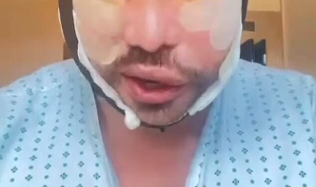 Bobby Norris has shared new pictures of his swollen and bruised face with fans after undergoing more cosmetic surgery