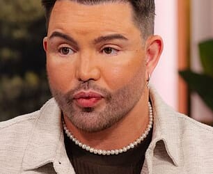 Bobby Norris is the last TOWIE star to unveil his dramatic new look after undergoing a facelift at the age of 39