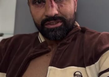 US boxer Paulie Malignaggi has complained about the treatment he received from the NHS