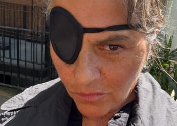 Dame Tracey Emin revealed she was recovering from eye surgery on Tuesday after months of partial blindness