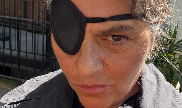 Dame Tracey Emin revealed she was recovering from eye surgery on Tuesday after months of partial blindness