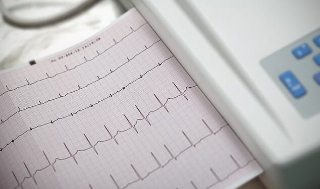 Resting heart rate refers to how many times your heart beats per minute - while you're sitting or lying down