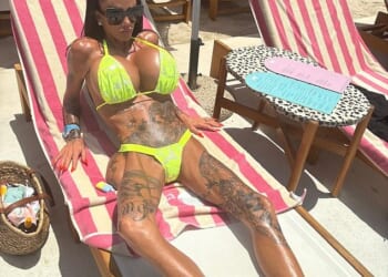 Katie Price revealed last year that she nearly died after undergoing a botched Brazilian Butt Lift (BBL) in 2019 to enhance her bottom and she has now shown the botched results