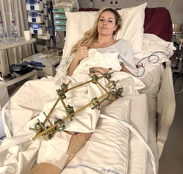 Vonn faced the threat of amputation after suffering a nasty leg injury at the Winter Olympics