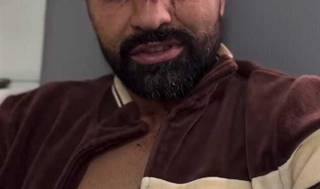 An NHS hospital has responded to complaints by a US bare-knuckle boxer on his health treatment
