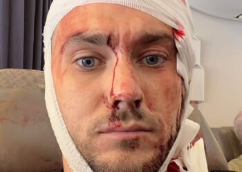Bradley Richards, a telecoms engineer, previously said he feared he would have to change careers after suffering life-changing injuries
