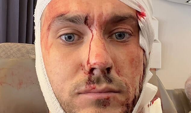 Bradley Richards, a telecoms engineer, previously said he feared he would have to change careers after suffering life-changing injuries