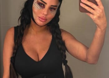 Earlier this month, TOWIE star Yaz Oukhellou admitted to going under the knife for a facelift - despite being just 31 years old